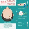PRP Therapy Treatment