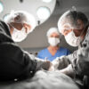 Liposuction surgery in Dubai
