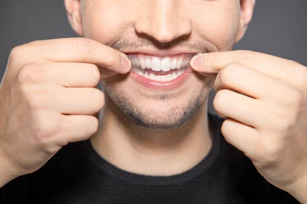 Teeth Whitening in Riyadh