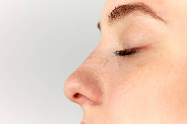 Rhinoplasty in Riyadh