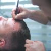 Hair Transplant in Riyadh