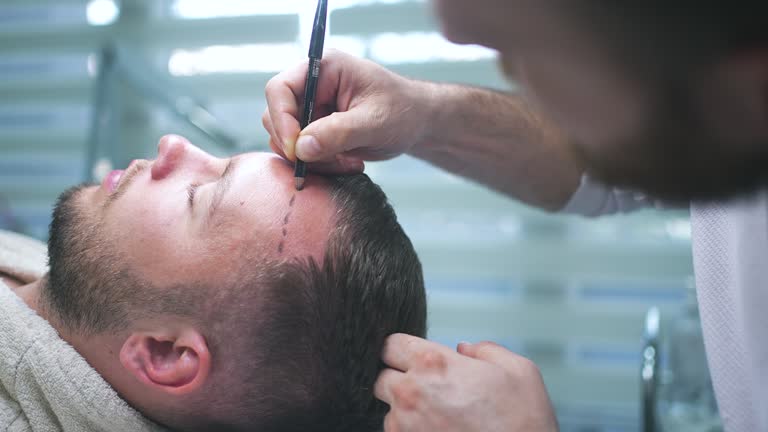 Hair Transplant in Riyadh